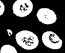 Morphology dilation.png