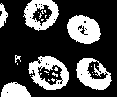 Morphology erosion.png